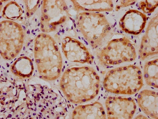 100UL GRHL1 ANTIBODY 100 ul