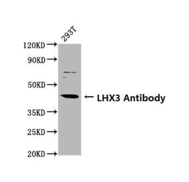 100UG LHX3 ANTIBODY 100 ug