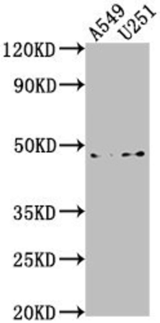 100UL B4GALT6 ANTIBODY 100 ul