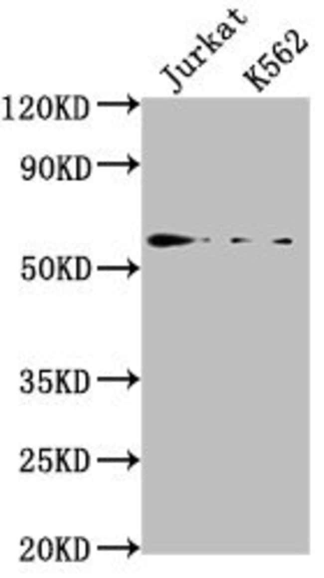 100UL HMGXB4 ANTIBODY 100 ul