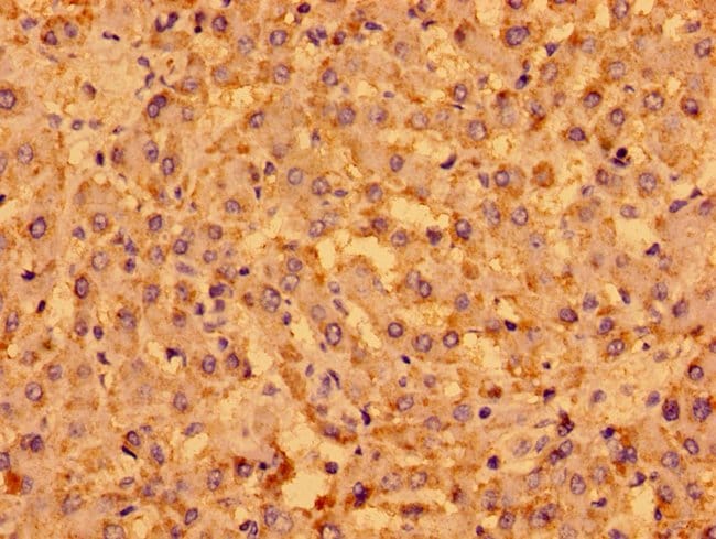 100UG MENT ANTIBODY 100 ug