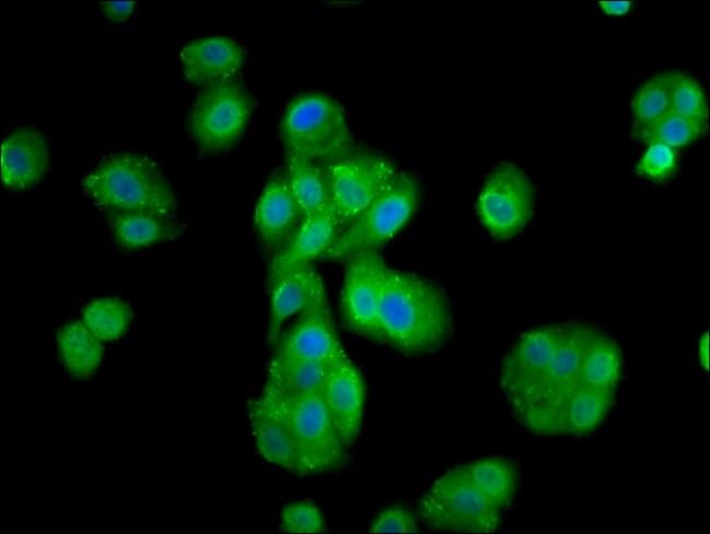 100UG MOV10L1 ANTIBODY 100 ug