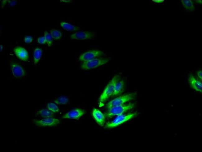 100UG TSCOT ANTIBODY 100 ug
