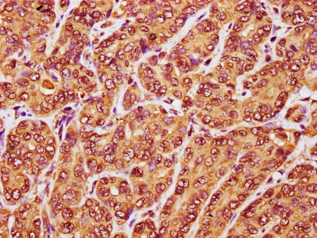 100UG RANBP17 ANTIBODY 100 ug