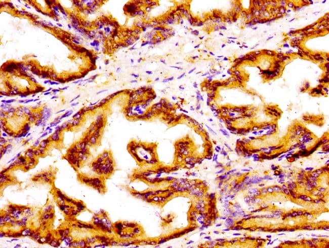 100UG GOLPH3 ANTIBODY 100 ug