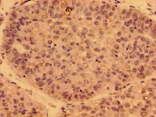 100UG PDF ANTIBODY 100 ug