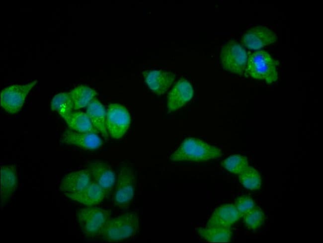 100UG MYOZ2 ANTIBODY 100 ug