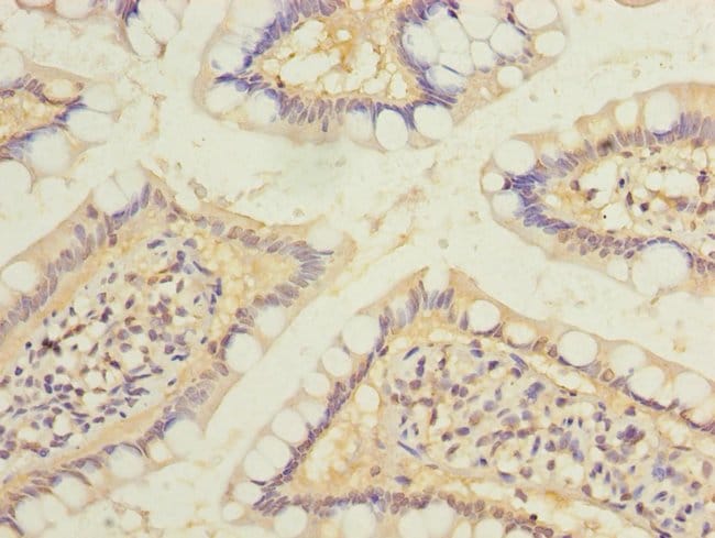 100UG RAB6B ANTIBODY 100 ug