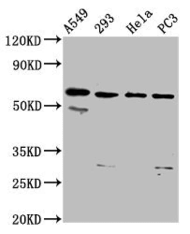 100UG DDX28 ANTIBODY 100 ug