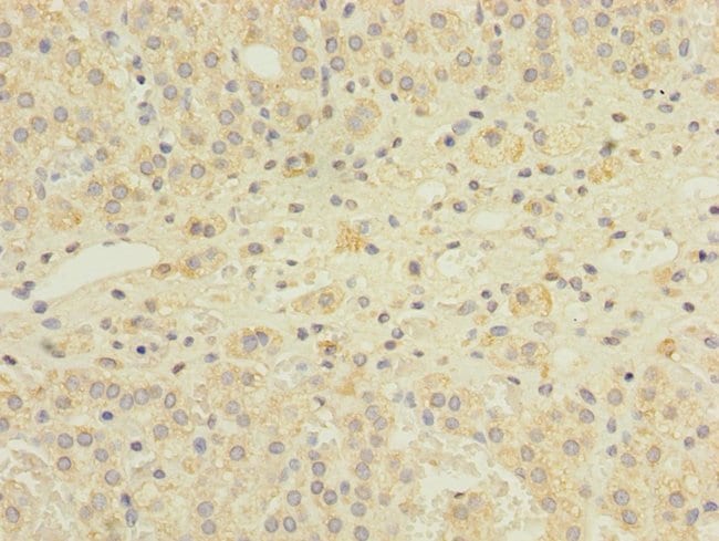 100UG GEMIN8 ANTIBODY 100 ug