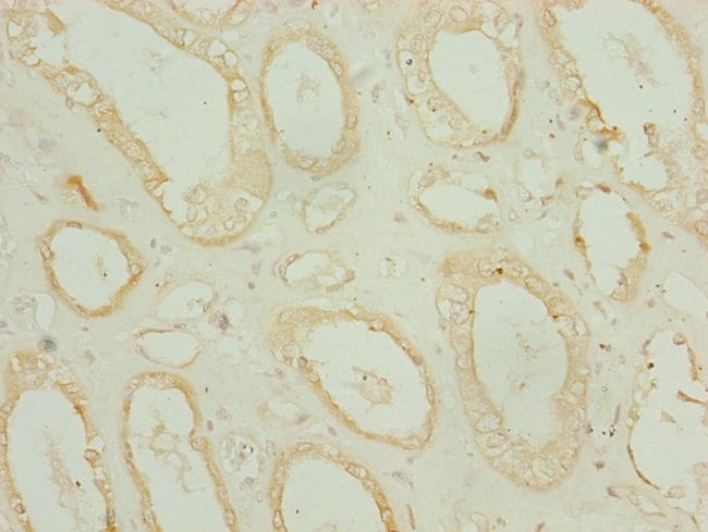 100UL CHCHD3 ANTIBODY 100 ul