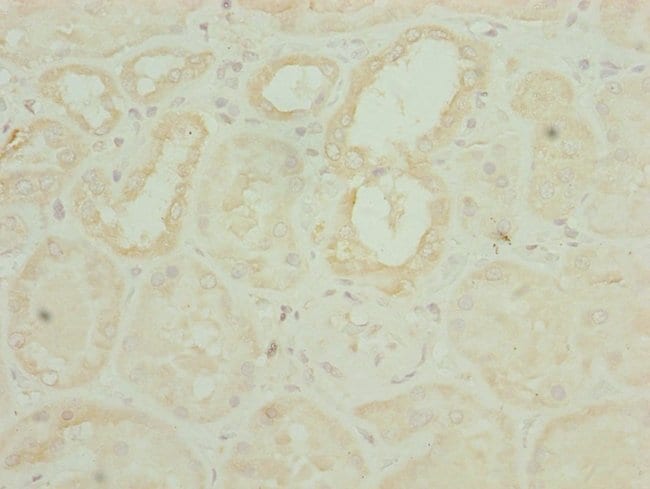 100UL CHCHD3 ANTIBODY 100 ul