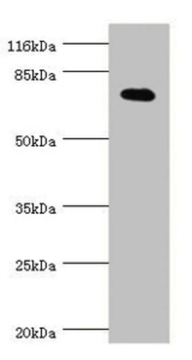 100UL KV4.2 (KCND2) ANTIBODY 100 ul
