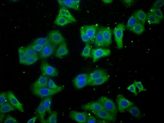 100UL LARS ANTIBODY 100 ul
