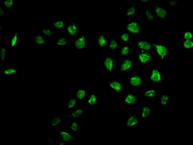 100UG MRO ANTIBODY 100 ug