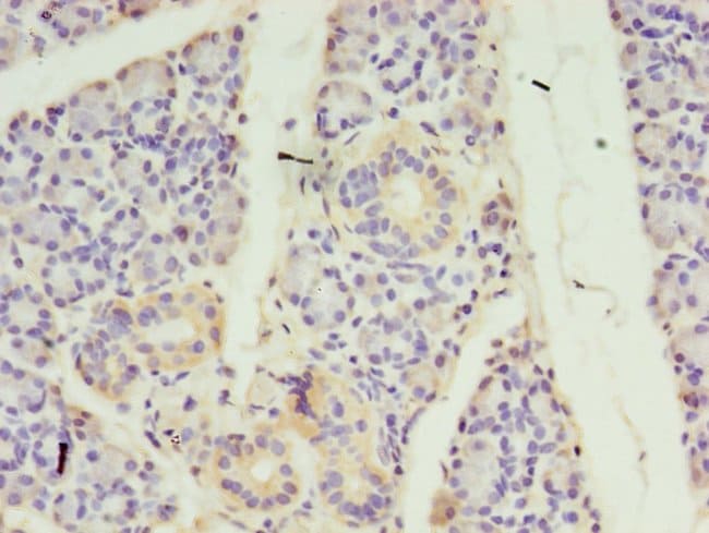 100UG ALS2CR2 ANTIBODY 100 ug
