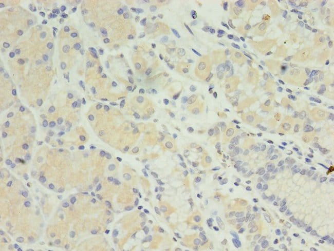 100UG MIS12 ANTIBODY 100 ug