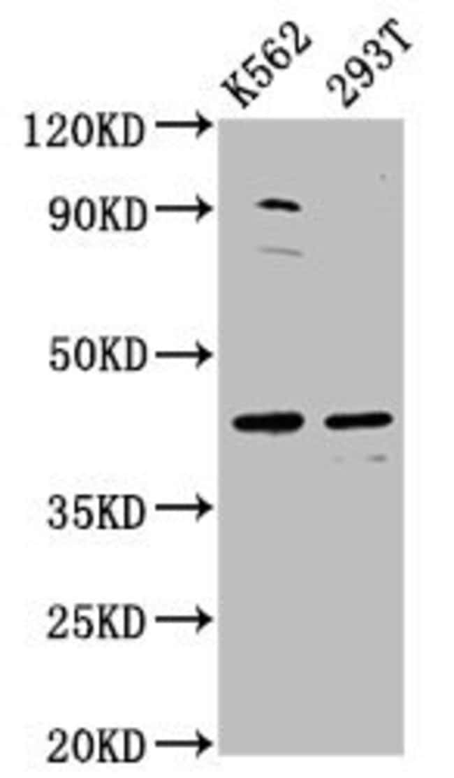 100UG XKR8 ANTIBODY 100 ug