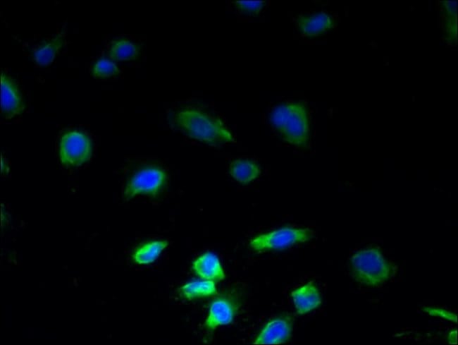 100UG PLGRKT ANTIBODY 100 ug