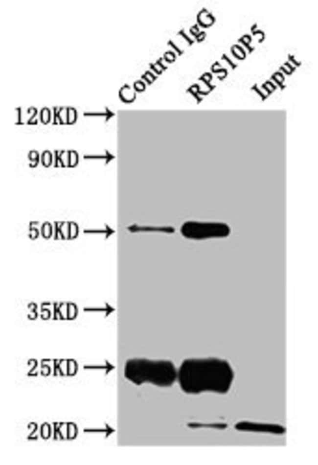 100UG RPS10P5 ANTIBODY 100 ug