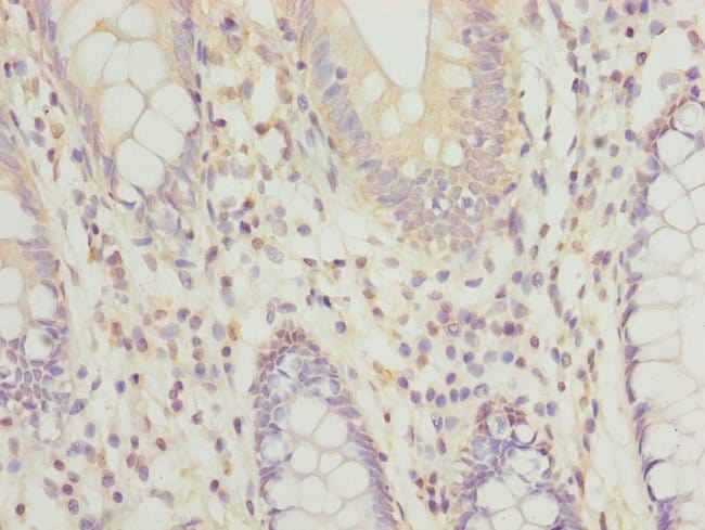 100UG RPRD1B ANTIBODY 100 ug