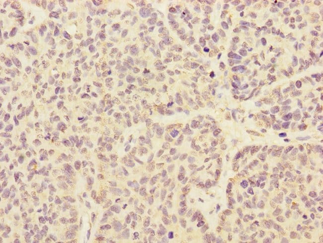100UL ARHGEF3 ANTIBODY 100 ul