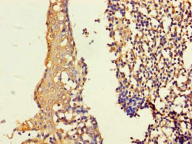 100UG ASF1B ANTIBODY 100 ug