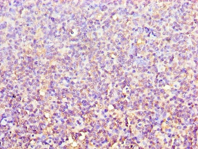 100UL ACTR3B ANTIBODY 100 ul