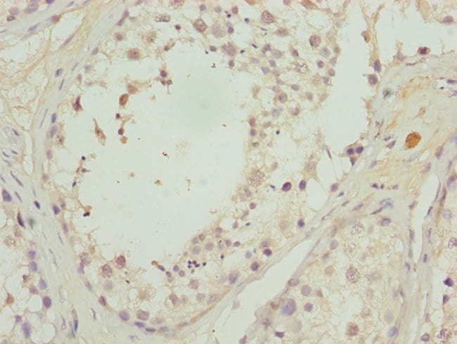 100UL CALCOCO1 ANTIBODY 100 ul