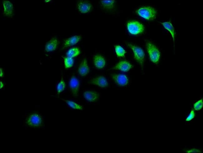 100UG EFHD1 ANTIBODY 100 ug