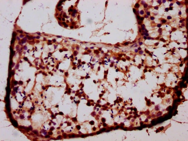 100UG BARHL1 ANTIBODY 100 ug