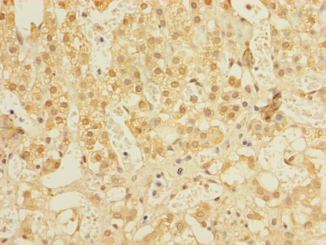 100UG ALS2CR1 ANTIBODY 100 ug