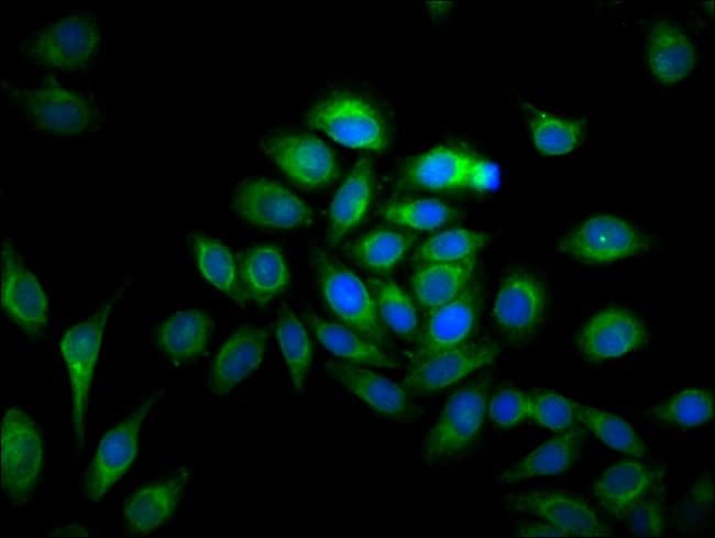 100UG MMP28 ANTIBODY 100 ug