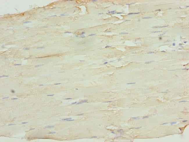 100UG SH3BGRL3 ANTIBODY 100 ug