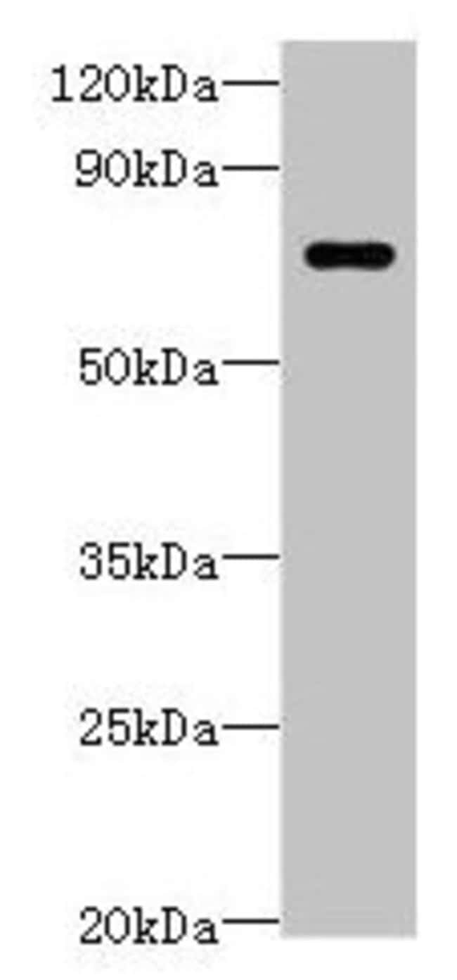100UG LRRC40 ANTIBODY 100 ug