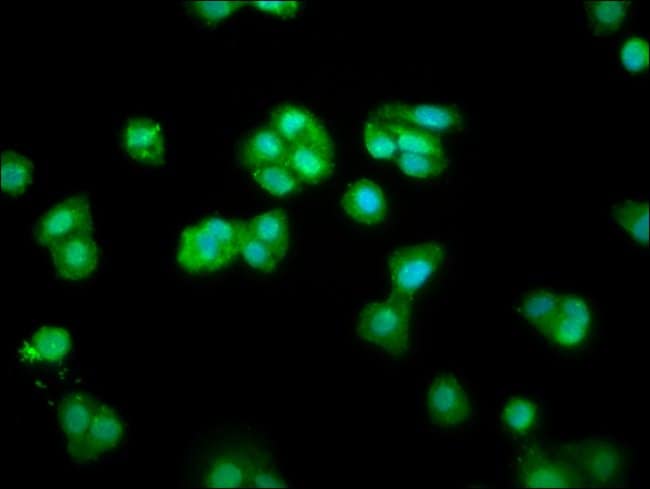 100UG CHMP1A ANTIBODY 100 ug