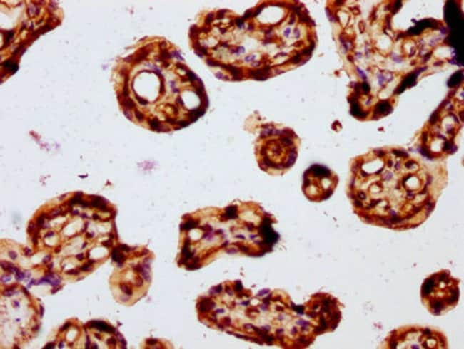 100UL FZD3 ANTIBODY 100 ul