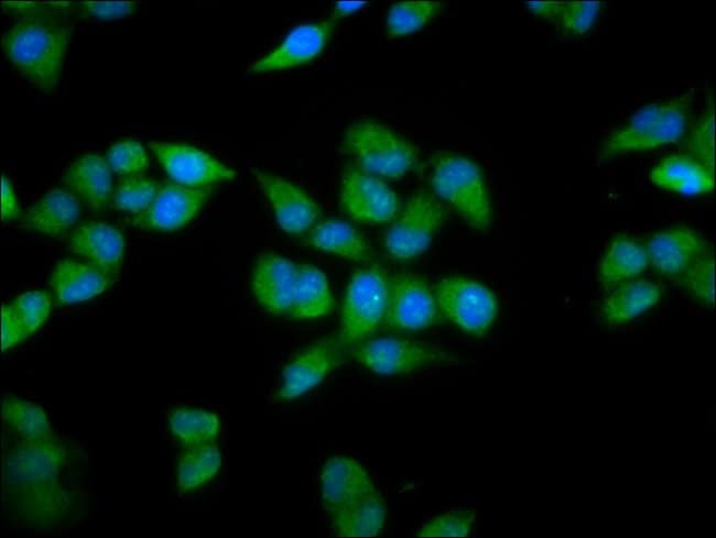 100UG PRDM11 ANTIBODY 100 ug