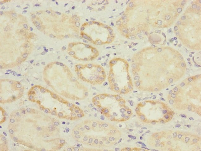 100UL IL17RB ANTIBODY 100 ul