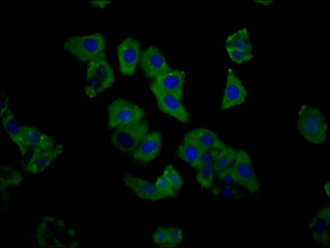 100UG C1GALT1 ANTIBODY 100 ug