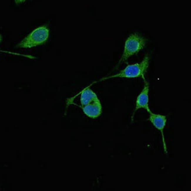 100UG RMND1 ANTIBODY 100 ug