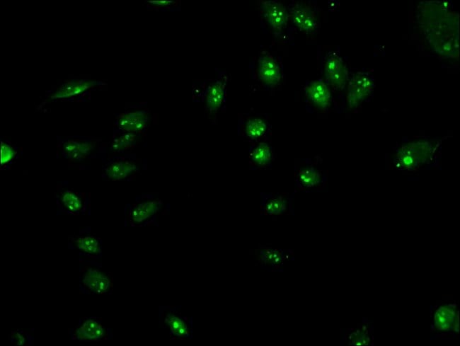 100UG LYAR ANTIBODY 100 ug