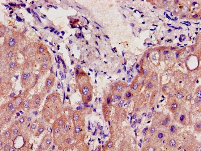 100UG CYP39A1 ANTIBODY 100 ug