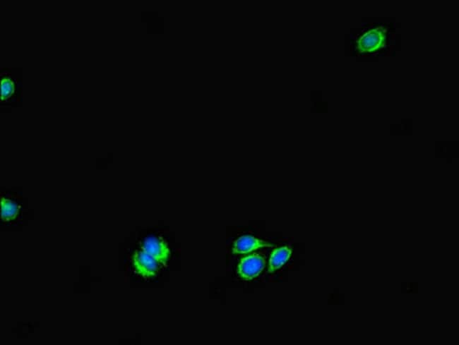 100UG UVRAG ANTIBODY 100 ug