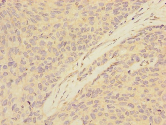 100UL ATXN10 ANTIBODY 100 ul