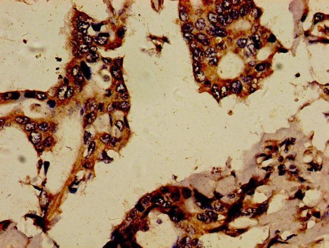100UG RBPJL ANTIBODY 100 ug