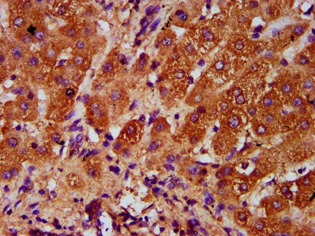 100UG AASS ANTIBODY 100 ug