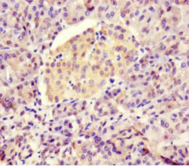 100UG BTNL2 ANTIBODY 100 ug