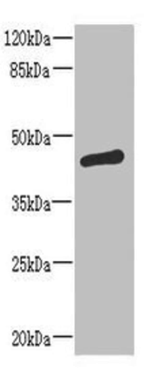 100UG ST6GALNAC2 ANTIBODY 100 ug