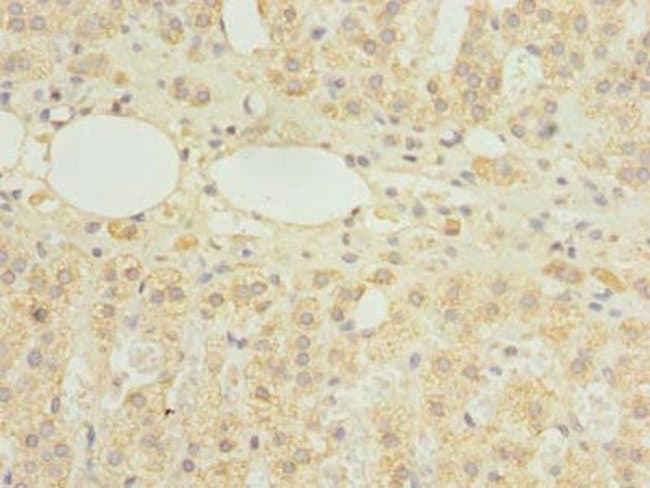 100UG HDHD3 ANTIBODY 100 ug